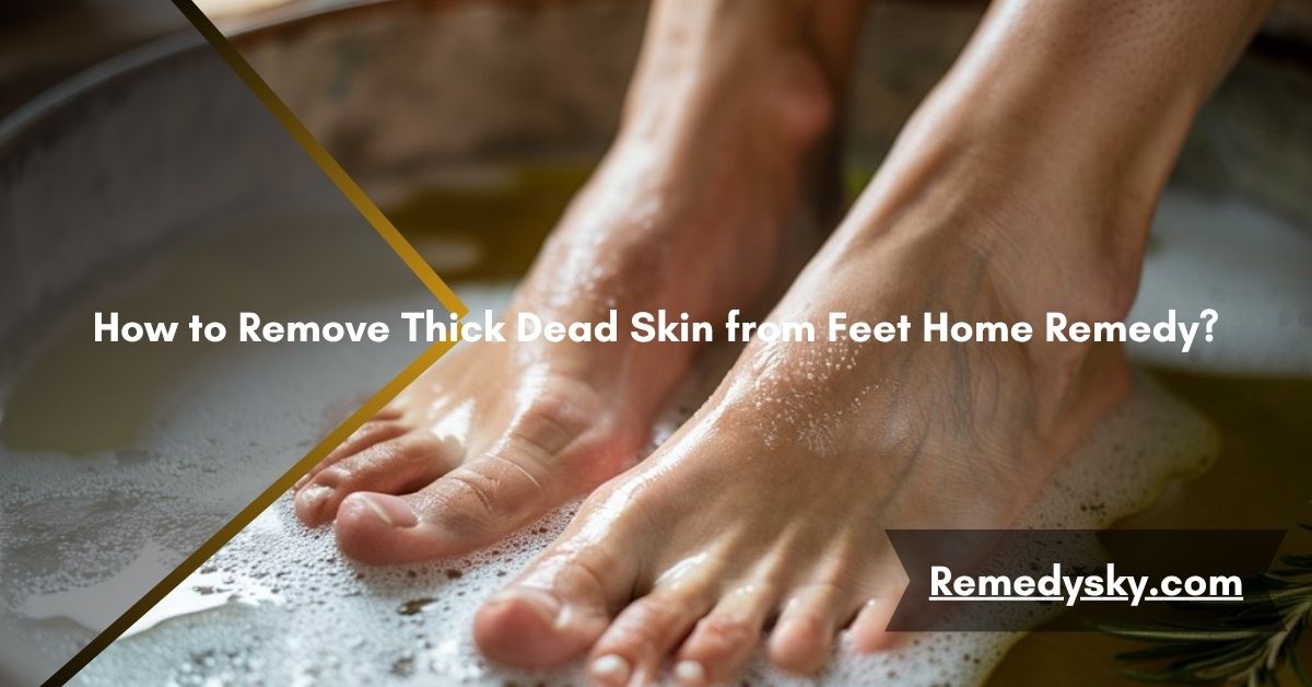 How to Remove Thick Dead Skin from Feet Home Remedy?