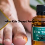 What Kills Toenail Fungus Instantly